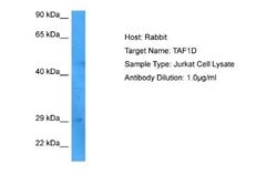 TAF1D Rabbit anti-Human, Polyclonal, Novus Biologicals 0.1 mL | Buy Online | Novus Biologicals | Fisher Scientific
